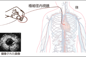 ［プレスリリース］髪の毛の太さと同じ！ 直径0.1 mmの光ファイバー1本からなるレンズのいらない内視鏡技術の開発に成功！ 〜血液除去がいらない超低侵襲医療の扉を拓く〜